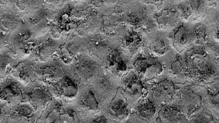 tooth enamel surface tooth enamel surface