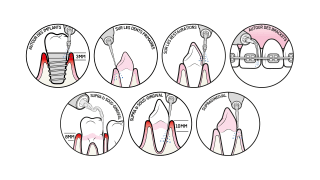 PIezon icon 16/9 FR