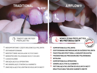 PL - GBT vs old methods comparison