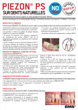 piezon ps sur dents naturelles