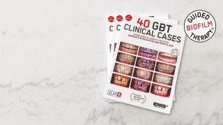40 GBT clinical cases