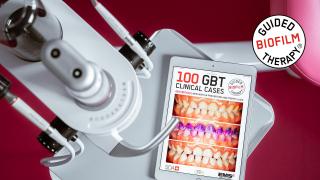 Embracing Gentle Technology: EMS Airflow Scaling for Optimal Oral Health