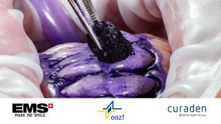Modernes Biofilmmanagement