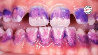 Discover another 100 best GBT Cases Vol. 4