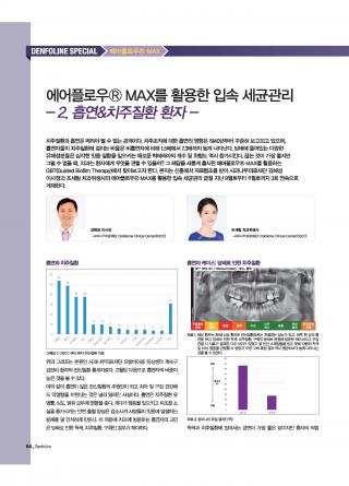 에어플로우® MAX를 활용한 입속 세균 관리 - 흡연 치주