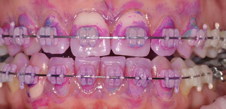 Ortho Nov 2019 KO